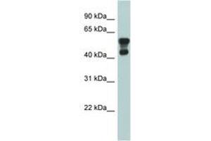 Image no. 1 for anti-Platelet-Activating Factor Acetylhydrolase 1b, Regulatory Subunit 1 (45kDa) (PAFAH1B1) (AA 71-120) antibody (ABIN6743973) (PAFAH1B1 anticorps  (AA 71-120))