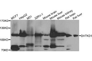 Western blot analysis of extracts of various cell lines, using DHTKD1 antibody. (DHTKD1 anticorps)