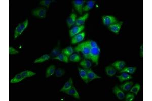 Immunofluorescence staining of Hela cells with ABIN7162115 at 1:33, counter-stained with DAPI. (Obscurin anticorps  (AA 1621-1712))