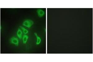 Immunofluorescence analysis of HepG2 cells, using TNFA Antibody. (TNF alpha anticorps  (AA 141-190))