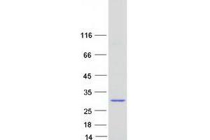 Validation with Western Blot