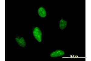 Immunofluorescence of monoclonal antibody to ATOH1 on HeLa cell. (ATOH1 anticorps  (AA 266-354))