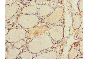 Immunohistochemistry of paraffin-embedded human thyroid tissue using ABIN7168009 at dilution of 1:100 (RHOBTB1 anticorps  (AA 240-400))