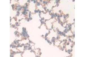 Used in DAB staining on fromalin fixed paraffin- embedded Kidney tissue