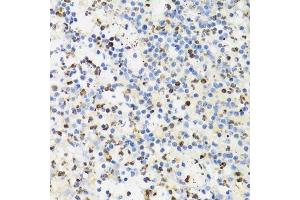 Immunohistochemistry of paraffin-embedded human appendicitis using SUMO4 Antibody.