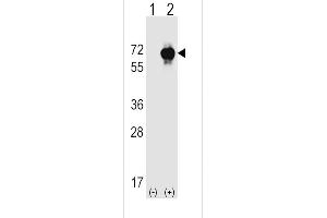Western blot analysis of SK (arrow) using rabbit polyclonal SK Antibody  (ABIN392497 and ABIN2842067).
