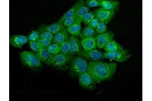 IF analysis of NSE using anti-NSE antibody (ABIN6719549). (ENO2/NSE anticorps)