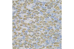 Immunohistochemistry of paraffin-embedded mouse stomach using EFN Antibody (ABIN6127874, ABIN6139961, ABIN6139962 and ABIN6220974) at dilution of 1:100 (40x lens).