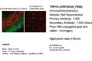 Immunohistochemistry (IHC) image for anti-Transient Receptor Potential Cation Channel, Subfamily V, Member 4 (TRPV4) (Middle Region) antibody (ABIN2776240) (TRPV4 anticorps  (Middle Region))