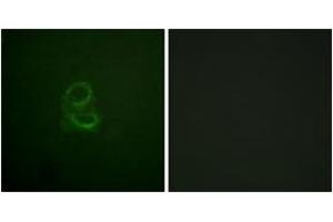 Immunofluorescence analysis of A549 cells, using IL-4R/CD124 (Ab-497) Antibody. (IL4 Receptor anticorps  (AA 463-512))