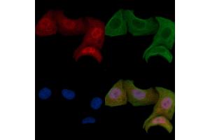 ABIN6255699 and ABIN6267466 staining Hela cells by IF/ICC. (CDC25A anticorps  (pThr507))