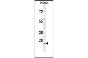 MCART2 anticorps  (N-Term)