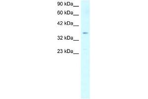 SCD antibody used at 1 ug/ml to detect target protein. (SCD anticorps)