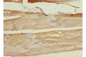 Immunohistochemistry of paraffin-embedded human skeletal muscle tissue using ABIN7149412 at dilution of 1:100