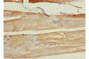 Immunohistochemistry of paraffin-embedded human skeletal muscle tissue using ABIN7149412 at dilution of 1:100 (PLA2G4C anticorps  (AA 1-189))