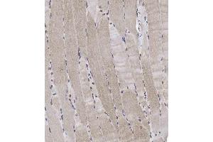 Immunohistochemical analysis of A on paraffin-embedded Human skeletal muscle tissue.