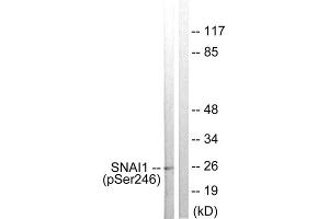 Western blot analysis of extracts from HT29 cells, using SNAI1 (Phospho-Ser246) antibody. (SNAIL anticorps  (pSer246))