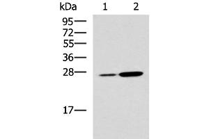 Western blot analysis of Mouse kidney tissue and Mouse liver tissue lysates using NQO2 Polyclonal Antibody at dilution of 1:1000