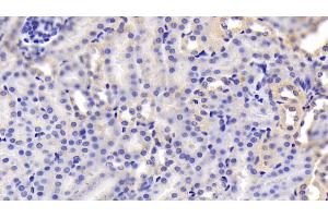 anti-Uridine Phosphorylase 1 (UPP1) (AA 1-277) antibody