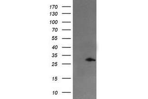 Image no. 1 for anti-Snail Family Zinc Finger 2 (SNAI2) antibody (ABIN1502651) (SLUG anticorps)