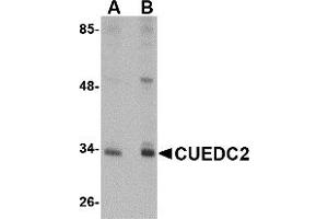 Western Blotting (WB) image for anti-CUE Domain Containing 2 (CUEDC2) (C-Term) antibody (ABIN1030352)