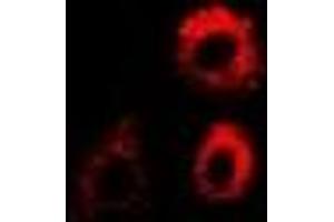 Immunofluorescent analysis of PTRH2 staining in MCF7 cells. (PTRH2 anticorps)