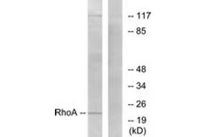 Western blot analysis of extracts from HepG2 cells, using RhoA (Ab-188) Antibody. (RHOA anticorps  (AA 144-193))
