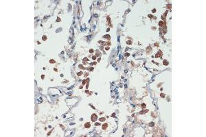 Immunohistochemistry of paraffin-embedded human lung using APC antibody (ABIN1678689, ABIN1678690, ABIN5664154 and ABIN6219837) at dilution of 1:200 (40x lens).