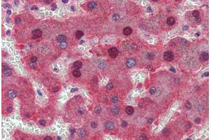 Human Liver: Formalin-Fixed, Paraffin-Embedded (FFPE)