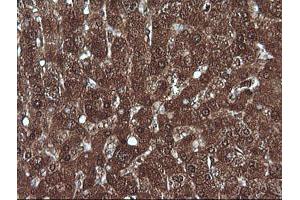 Image no. 4 for anti-Melan A (MLANA) antibody (ABIN1499425) (MLANA anticorps)