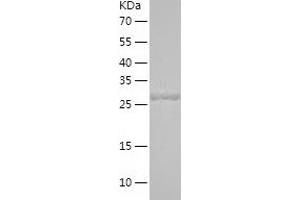 Western Blotting (WB) image for Stanniocalcin 2 (STC2) (AA 25-302) protein (His tag) (ABIN7125206)