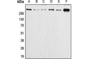 Western blot analysis of APC (pS2054) expression in HeLa (A), Caco2 (B), SW480 (C), MCF7 (D), SP2/0 (E), PC12 (F) whole cell lysates. (APC anticorps  (pSer2054))