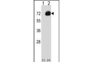 Western blot analysis of CTPS2 (arrow) using rabbit polyclonal CTPS2 Antibody (C-term) (ABIN656954 and ABIN2846140). (CTPS2 anticorps  (C-Term))