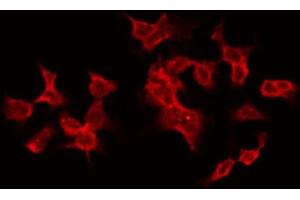 ABIN6268846 staining HT29 by IF/ICC. (TANK anticorps  (Internal Region))