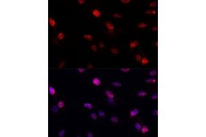 Immunofluorescence analysis of C6 cells using BRC antibody (1318) at dilution of 1:100. (BRCA1 anticorps  (AA 400-699))