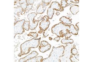 Immunohistochemistry (IHC) image for anti-Epidermal Growth Factor Receptor (EGFR) (AA 1100-1150) antibody (ABIN7795640) (Recombinant EGFR anticorps  (AA 1100-1150))