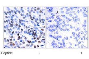 Image no. 1 for anti-Jun B Proto-Oncogene (JUNB) (Ser259) antibody (ABIN197140) (JunB anticorps  (Ser259))