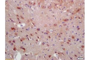 Formalin-fixed and paraffin embedded rat brain labeled with Anti-MRF/C11orf9 Polyclonal Antibody, Unconjugated (ABIN1386454) at 1:200 followed by conjugation to the secondary antibody and DAB staining (Chromosome 11open Reading Frame 9 (C11orf9) (AA 401-500) anticorps)