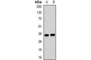 Western blot analysis of Tropomyosin 3 expression in mouse lung (A), mouse heart (B) whole cell lysates. (TPM3 anticorps)
