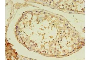 Immunohistochemistry of paraffin-embedded human testis tissue using ABIN7160592 at dilution of 1:100 (MYH7B anticorps  (AA 1-176))