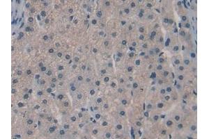 Detection of SPRY3 in Human Liver Tissue using Polyclonal Antibody to Sprouty Homolog 3 (SPRY3)
