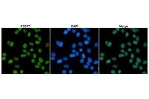 Immunofluorescent analysis of Hela cells fixed with 4 % Paraformaldehyde and using anti-RBBP5 mouse mAb (dilution 1:100). (RBBP5 anticorps)