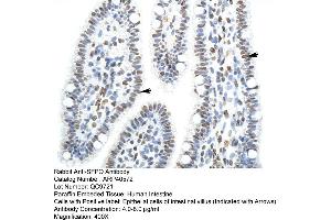Rabbit Anti-SFPQ Antibody  Paraffin Embedded Tissue: Human Intestine Cellular Data: Epithelial cells of intestinal villas Antibody Concentration: 4.