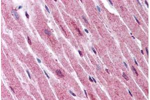 Human Heart (formalin-fixed, paraffin-embedded) stained with ADAMTS4 antibody ABIN290074 at 2. (ADAMTS4 anticorps  (Internal Region))