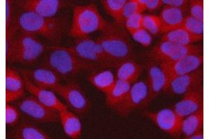 IF analysis of RPS15A using anti-RPS15A antibody (ABIN7598954).
