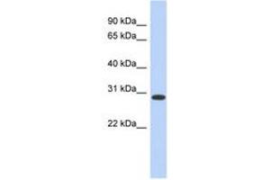 Image no. 1 for anti-Homeobox D12 (HOXD12) (AA 179-228) antibody (ABIN6742239) (HOXD12 anticorps  (AA 179-228))