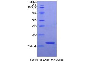 SDS-PAGE analysis of Rat Oncomodulin Protein.