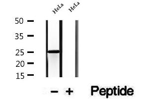 Western blot analysis of extracts of HeLa cells, using CHCHD6 antibody. (CHCHD6 anticorps  (Internal Region))