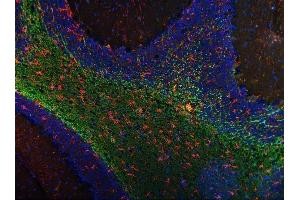 anti-Myelin Associated Glycoprotein (MAG) (AA 34-605) antibody