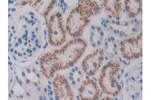 DAB staining on IHC-P; Samples: Rat Kidney Tissue (ODC1 anticorps  (AA 1-461))